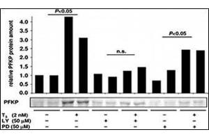 Image no. 2 for anti-phosphofructokinase, Platelet (PFKP) (C-Term) antibody (ABIN6749803) (PFKP antibody  (C-Term))