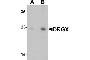 Western blot analysis of DRGX in rat liver tissue lysate with DRGX antibody at (A) 1 and (B) 2 µg/mL. (DRGX antibody  (C-Term))