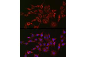 Immunofluorescence analysis of NIH/3T3 cells using GLB1 Rabbit pAb (ABIN3015642, ABIN3015643, ABIN3015644 and ABIN6218995) at dilution of 1:150 (40x lens). (GLB1 antibody  (AA 1-270))