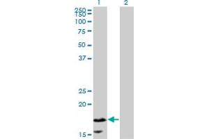 Western Blot analysis of CALML5 expression in transfected 293T cell line by CALML5 monoclonal antibody (M16), clone 2F10.