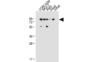 Western Blotting (WB) image for anti-Mdm2, p53 E3 Ubiquitin Protein Ligase Homolog (Mouse) (MDM2) (AA 393-424), (C-Term) antibody (ABIN388068)