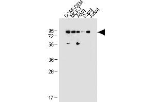 All lanes : Anti-MDM2 Antibody (C-term) at 1:1000 dilution Lane 1: CCRF-CEM whole cell lysate Lane 2: MCF-7 whole cell lysate Lane 3: A549 whole cell lysate Lane 4: Daudi whole cell lysate Lane 5: Jurkat whole cell lysate Lysates/proteins at 20 μg per lane. (MDM2 antibody  (C-Term))
