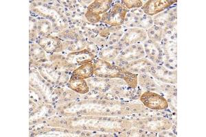 Immunohistochemistry of paraffin embedded mouse kidney using MRPS35 (ABIN7074655) at dilution of 1: 400 (300x lens) (MRPS35 antibody)