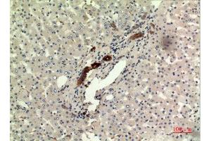 Immunohistochemistry (IHC) analysis of paraffin-embedded Human Liver, antibody was diluted at 1:100. (IFN omega (C-Term) antibody)