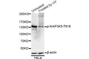 Western blot analysis of extracts of HeLa cells, using Phospho-MAP3K5-T918 antibody. (ASK1 antibody  (pThr918))