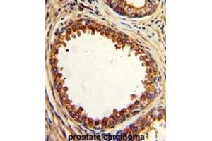 Immunohistochemistry (IHC) image for anti-Protein tyrosine Phosphatase Type IVA, Member 2 (PTP4A2) antibody (ABIN3002826) (PTP4A2 antibody)
