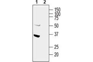 Western blot analysis of human U87-MG glioblastoma cell line lysate: - 1. (GIPC1 antibody  (Intracellular, N-Term))