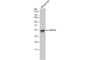 WB Image UGT1A antibody detects UGT1A protein by western blot analysis.