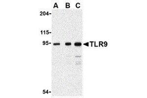 Western Blotting (WB) image for anti-Toll-Like Receptor 9 (TLR9) (Center) antibody (ABIN2479768) (TLR9 antibody  (Center))