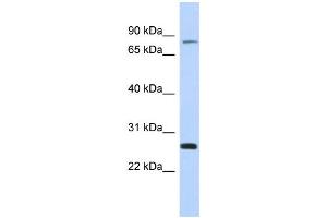 WB Suggested Anti-ZSCAN2 Antibody Titration:  0. (ZSCAN2 antibody  (Middle Region))