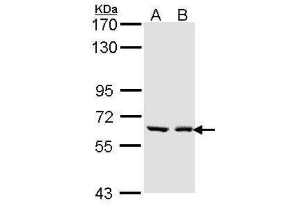 UGT1A6 抗体  (Center)
