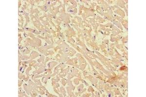 Immunohistochemistry of paraffin-embedded human heart tissue using ABIN7157632 at dilution of 1:100 (KIF24 antibody  (AA 1168-1368))