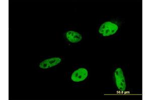 Immunofluorescence of monoclonal antibody to HEYL on HeLa cell. (HEYL antibody  (AA 221-327))