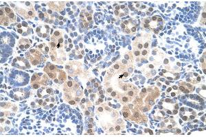 Human kidney (SLC25A45 antibody  (C-Term))