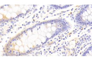 Immunohistochemistry (IHC) image for anti-Dipeptidyl-Peptidase 3 (DPP3) (AA 2-261) antibody (ABIN7445195)