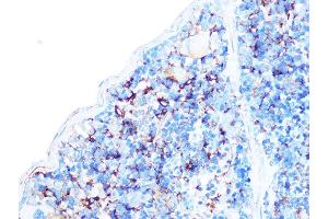 Immunohistochemistry of paraffin-embedded mouse spleen using Arp3 Rabbit mAb (ABIN7265676) at dilution of 1:100 (40x lens). (ACTR3 antibody)