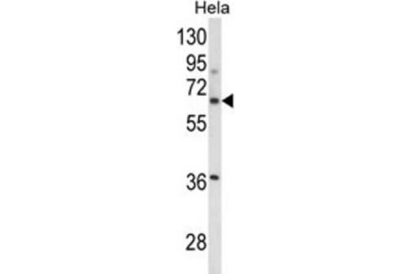 ITGBL1 antibody