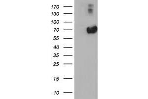 HEK293T cells were transfected with the pCMV6-ENTRY control (Left lane) or pCMV6-ENTRY AFP (Right lane) cDNA for 48 hrs and lysed. (alpha Fetoprotein antibody)