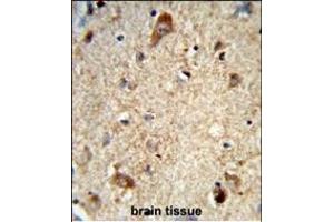 Formalin-fixed and paraffin-embedded human brain tissue reacted with DAB1 Antibody (Center), which was peroxidase-conjugated to the secondary antibody, followed by DAB staining. (DAB1 antibody  (AA 189-216))