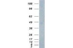 Validation with Western Blot (TSSK1B Protein (Myc-DYKDDDDK Tag))