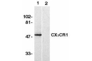 Western blot analysis of CX3CR1 in human spleen lysate with AP30264PU-N CX3CR1 antibody in the absence (lane 1) or presence of blocking peptide (lane 2).