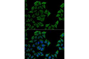 Immunofluorescence analysis of U2OS cell using TCN1 antibody.