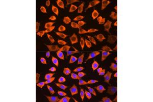 Immunofluorescence (IF) image for anti-Ribosomal Protein S3 (RPS3) (AA 1-243) antibody (ABIN3023343)