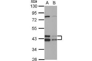 WB Image Sample (30 ug of whole cell lysate) A: HepG2 B: HCT116 10% SDS PAGE antibody diluted at 1:1000 (DNAJA3 antibody  (Center))