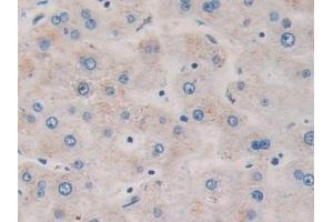 Detection of DDX58 in Human Liver Tissue using Polyclonal Antibody to Probable ATP-dependent RNA Helicase DDX58 (DDX58) (DDX58 antibody  (AA 550-776))