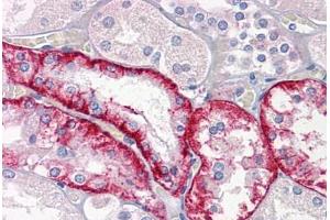 Human Kidney: Formalin-Fixed, Paraffin-Embedded (FFPE) (Cathepsin K antibody  (AA 220-331))