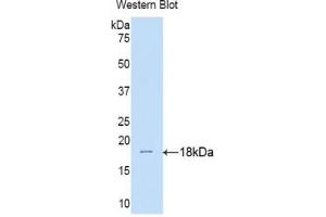 Western blot analysis of the recombinant protein. (IL17RA antibody  (AA 33-172))