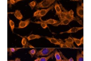 Immunofluorescence analysis of HeLa cells using USP36 Polyclonal Antibody at dilution of 1:100 (40x lens).