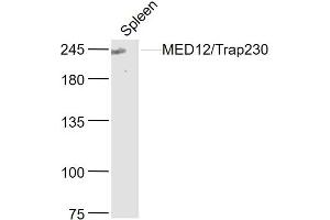 Mouse spleen lysates probed with MED12/Trap230 Polyclonal Antibody, Unconjugated  at 1:300 dilution and 4˚C overnight incubation.
