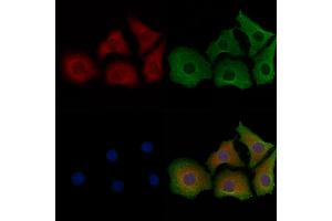 ABIN6261881, ABIN6267053, ABIN6267054 and ABIN6267055 staining Hela cells by IF/ICC. (GAPDH antibody)