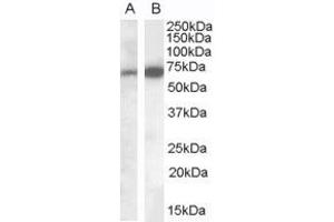 Western Blotting (WB) image for anti-Eukaryotic Elongation Factor, Selenocysteine-tRNA-Specific (EEFSEC) (C-Term) antibody (ABIN2790209) (EEFSEC antibody  (C-Term))