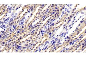 Detection of CFB in Rat Kidney Tissue using Polyclonal Antibody to Complement Factor B (CFB) (Complement Factor B antibody  (AA 34-159))