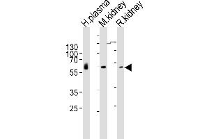 Western blot analysis of lysates from human plasma, mouse kidney, rat kidney tissue lysate (from left to right), using CNDP1 Antibody (Center) (ABIN6243352 and ABIN6577403). (CNDP1 antibody  (AA 128-142))