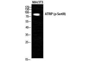 Western Blotting (WB) image for anti-ATR Interacting Protein (ATRIP) (pSer68) antibody (ABIN3182233) (ATRIP antibody  (pSer68))