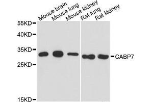 Western blot analysis of extracts of various cell lines, using CABP7 antibody.