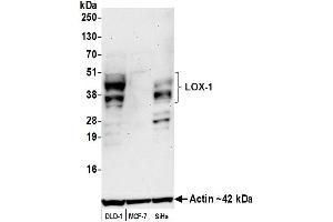 Western Blotting (WB) image for anti-Oxidized Low Density Lipoprotein (Lectin-Like) Receptor 1 (OLR1) (AA 61-273) antibody (ABIN7795657)