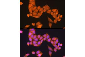 Immunofluorescence analysis of HeLa cells using Rap1B Rabbit pAb (ABIN6132985, ABIN6146685, ABIN6146686 and ABIN6216738) at dilution of 1:100 (40x lens). (RAP1B antibody  (AA 1-184))
