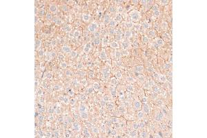 Immunohistochemistry of paraffin-embedded mouse liver using CDH18 antibody (ABIN6291131) at dilution of 1:100 (40x lens).