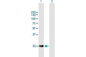Western Blot analysis of TERF2 expression in transfected 293T cell line by TERF2 MaxPab polyclonal antibody. (TRF2 antibody  (AA 1-251))