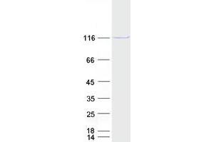 Validation with Western Blot (MATR3 Protein (Transcript Variant 2) (Myc-DYKDDDDK Tag))