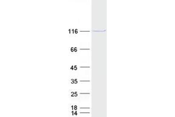 MATR3 Protein (Transcript Variant 2) (Myc-DYKDDDDK Tag)