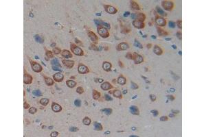 #VALUE! (Calcitonin Receptor antibody  (AA 34-148))