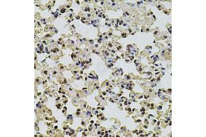 Immunohistochemistry of paraffin-embedded mouse lung using POT1 antibody. (POT1 antibody)