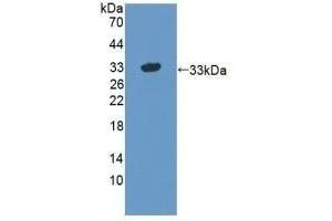 Detection of Recombinant STX1A, Human using Polyclonal Antibody to Syntaxin 1A, Brain (STX1A) (STX1A antibody  (AA 1-255))