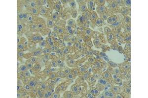 Used in DAB staining on fromalin fixed paraffin- embedded liver tissue (IL1RAP antibody  (AA 21-367))
