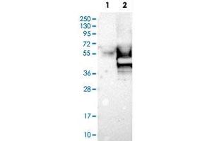 Western Blot analysis of Lane 1: negative control (vector only transfected HEK293T cell lysate) and Lane 2: over-expression lysate (co-expressed with a C-terminal myc-DDK tag in mammalian HEK293T cells) with GAP43 polyclonal antibody . (GAP43 antibody)